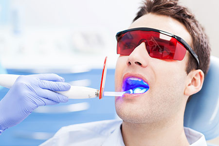 Dentist Ultraviolet Light Equipment