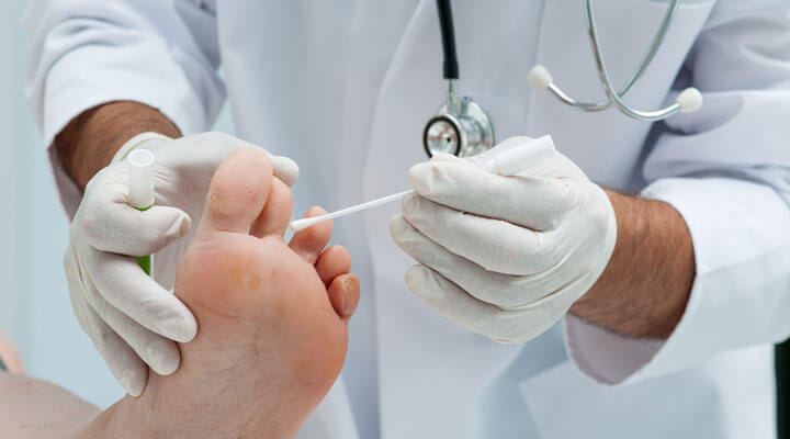 Dermatología Integral "Medica Grijalva"  - HONGOS