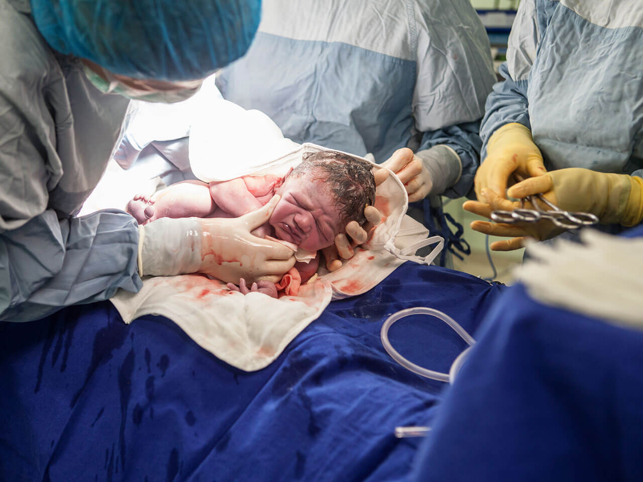 Gineco Mérida Vargas - PARTOS Y CESAREAS