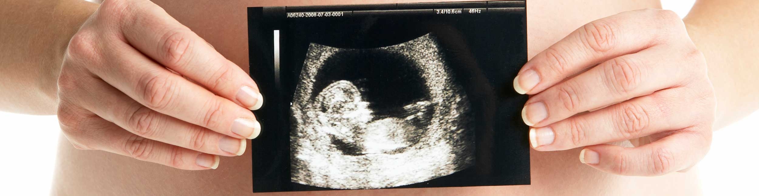Consultorio de Ginecología - ultrasonido