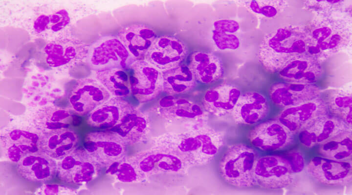 Infectólogo - TIFOIDEA