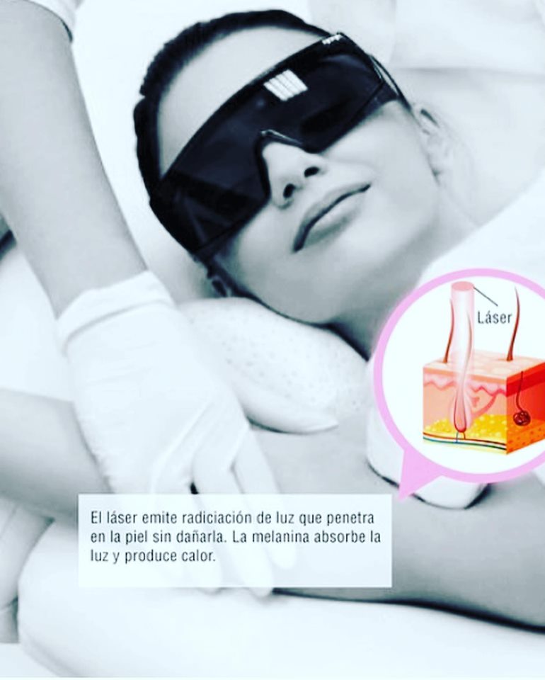 Depilación Láser Diodo