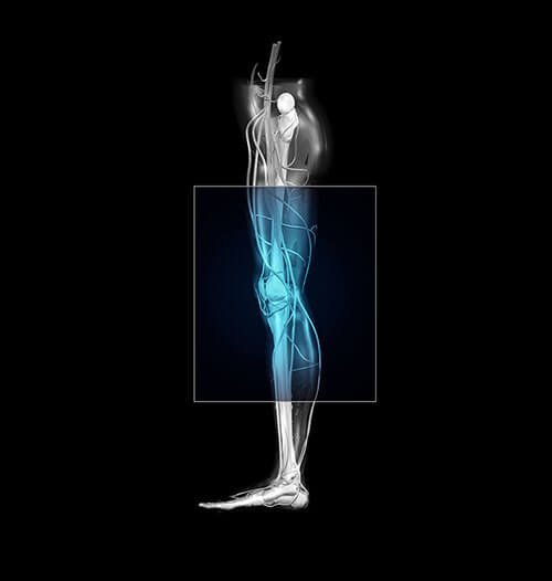 Rayos X Garatec- Evaluación de osteoporosis