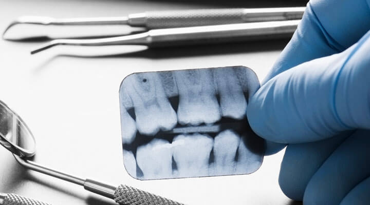 Orthodontic Dental Center - PROTRUSION