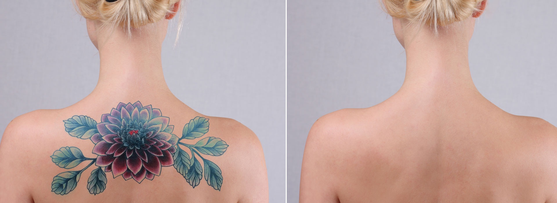 Aesthetic Clinic Skin Clinic Yuma Yuma Laser Center