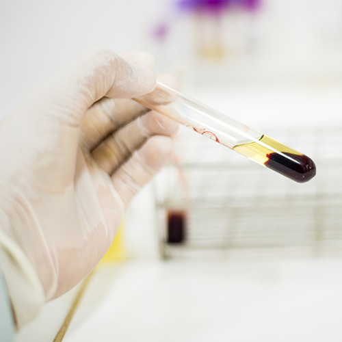 laboratory test
