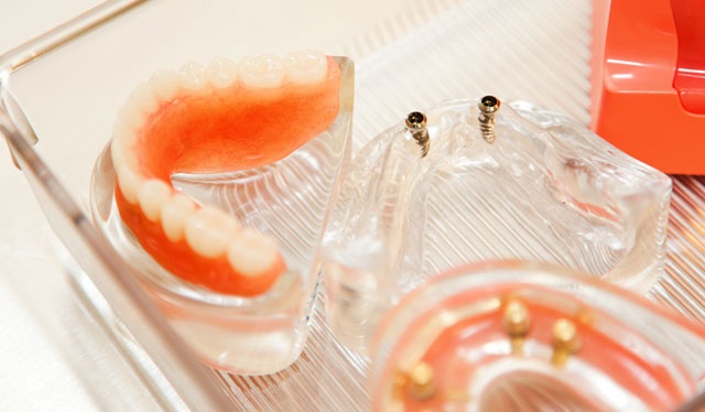 Vimarz Soluciones Dentales  - CARILLAS