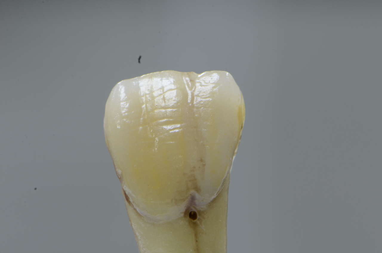 Dental Galia – Prótesis dentales
