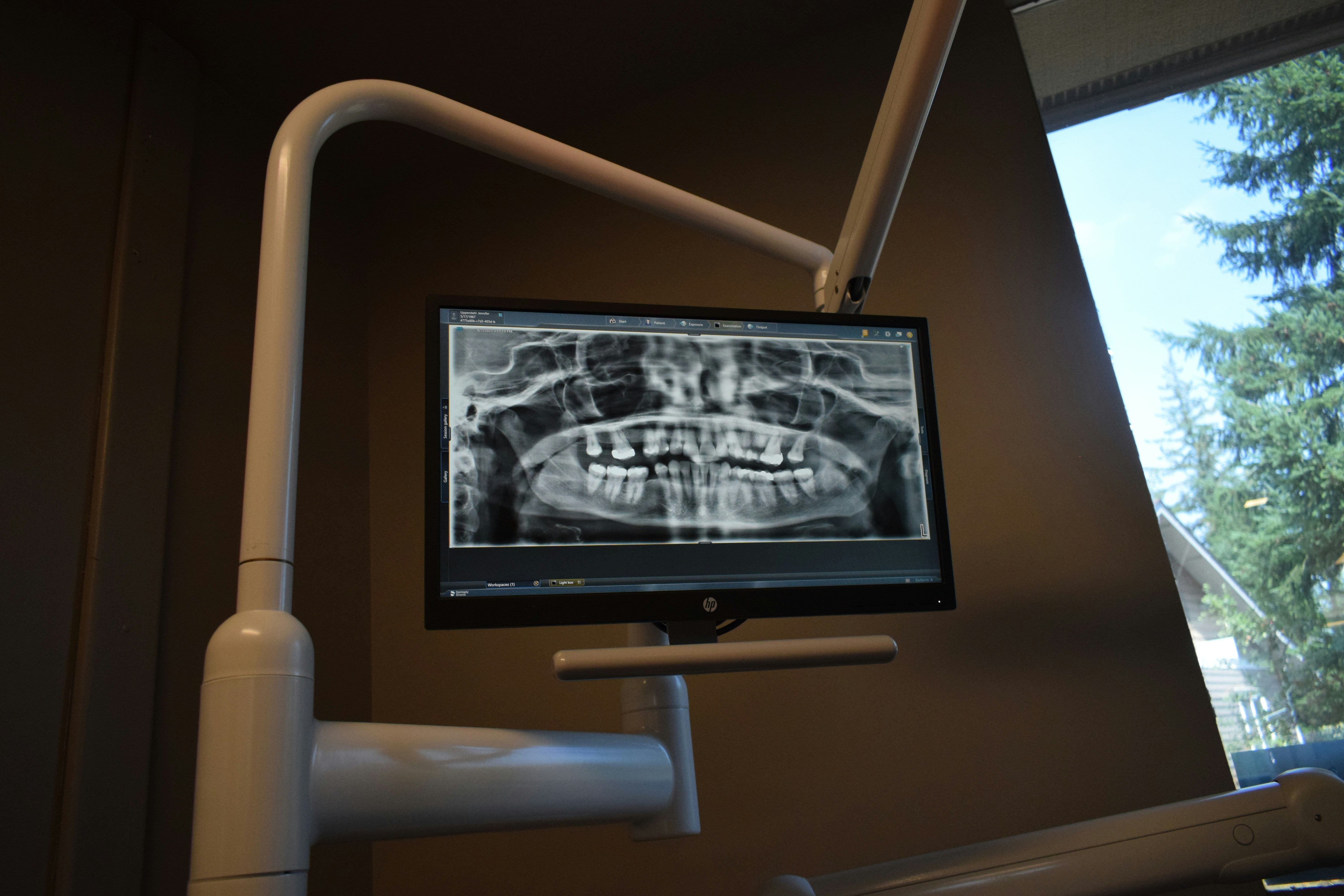 Dental x-ray displayed on a monitor in a clinic setting.