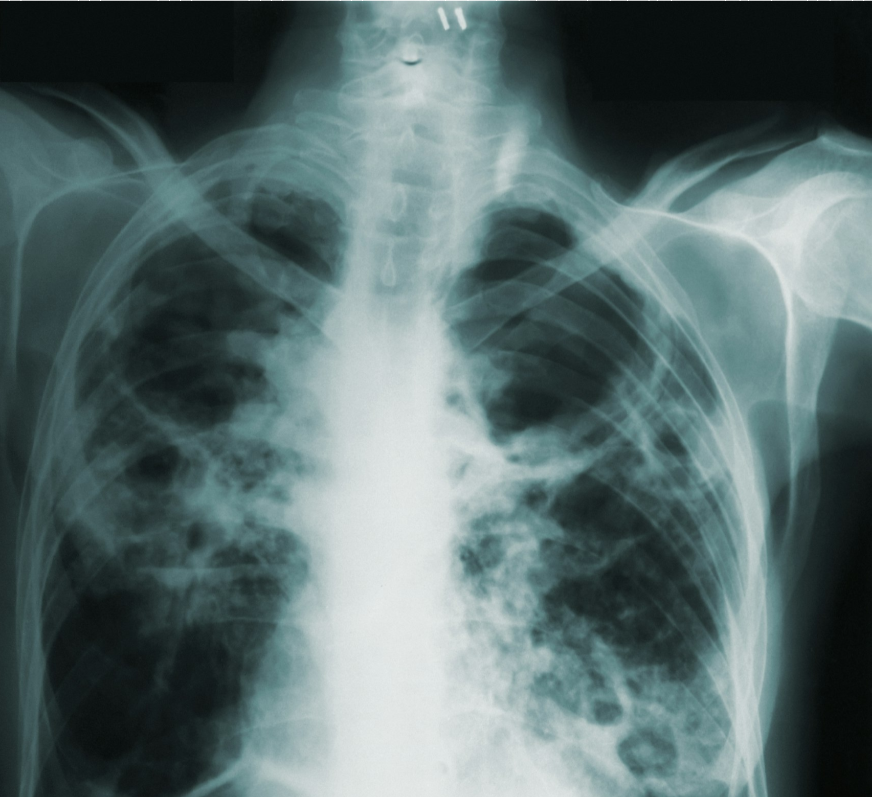 Sala de resonancia magnética con tres médicos usando equipo quirúrgico.