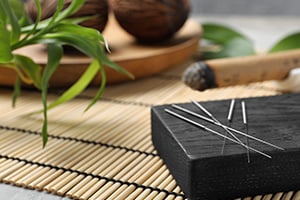 Acupuncture and Other Therapies