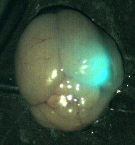 An image of a mouse brain tumor under near-infrared light. The blue-green glow in the upper right quadrant is the tumor, labeled with tumor paint. An image of a mouse brain tumor under near-infrared light. The blue-green glow in the upper right quadrant is the tumor, labeled with tumor paint.