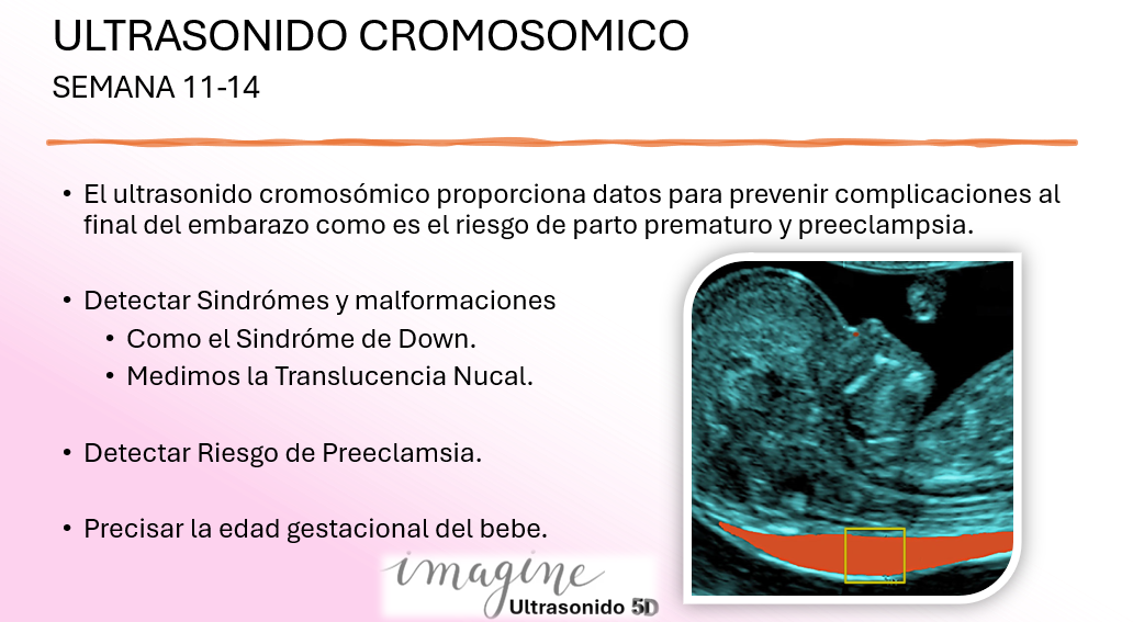 Ícono del enlace