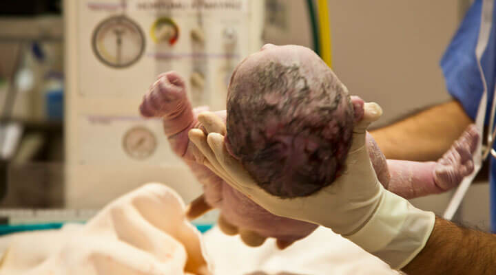 Consultorio Médico de Dr. Carlo Mario Atondo León - PARTOS