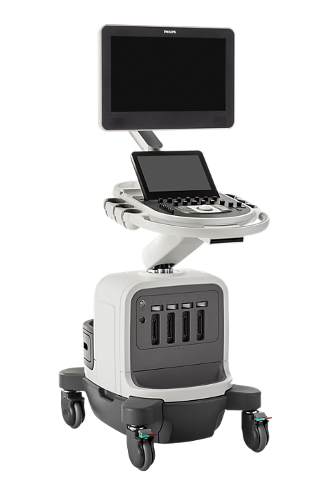 https://0201.nccdn.net/1_2/000/000/107/fd9/ecografo-philips-470x705.png