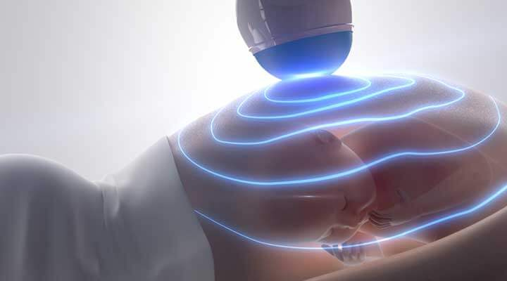 Consultorio en Ginecología Arredondo- ULTRASONIDO