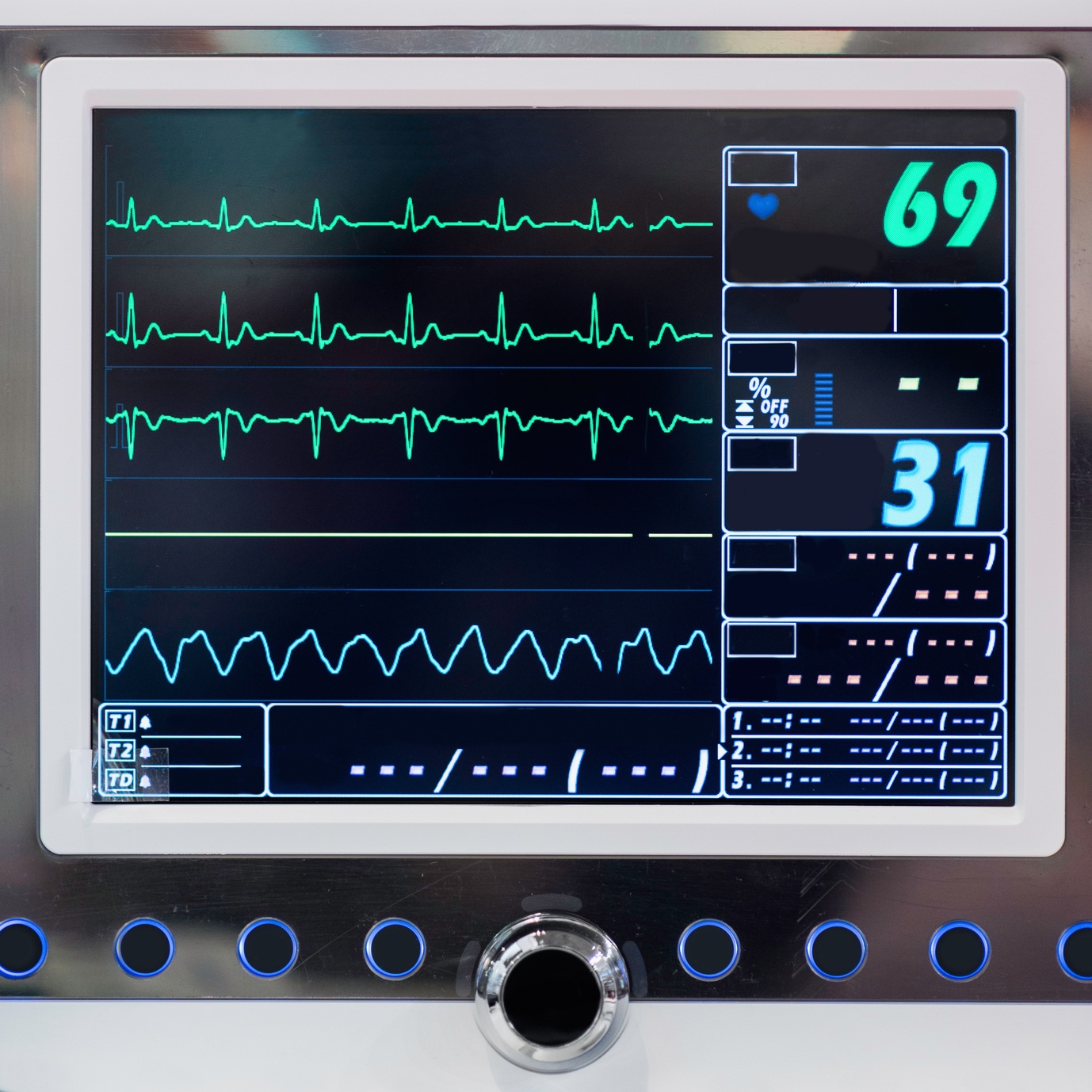 Vital signs monitor