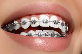 ESTÉTICA DENTAL