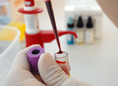 Diagnóstico por Imagen del Ángel - Estudios de laboratorio