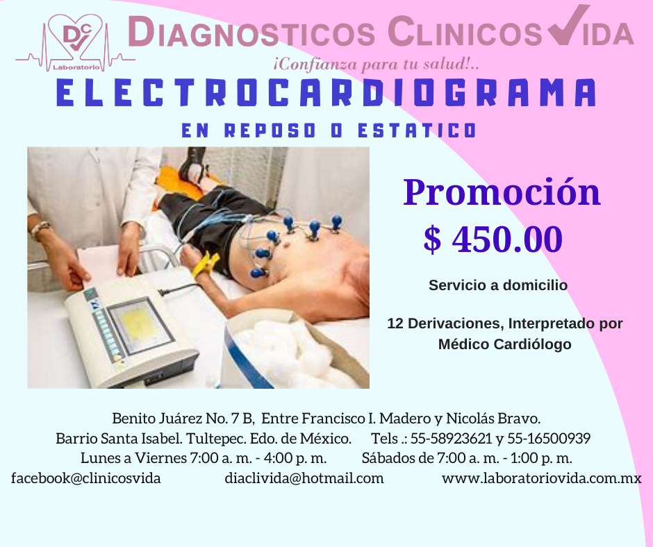 https://0201.nccdn.net/1_2/000/000/120/c25/electrocardiograma.png