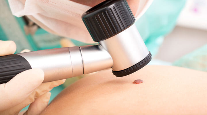 Dermatología Integral "Medica Grijalva"  - ARRUGAS