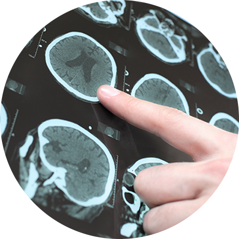 NEUROFIM - Estudios clínicos neurológicos