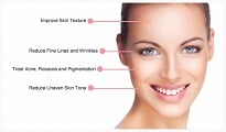 Laser Skin Tightening in Palm Harbor FL - Sublime wrinkle reduction and skin tightening