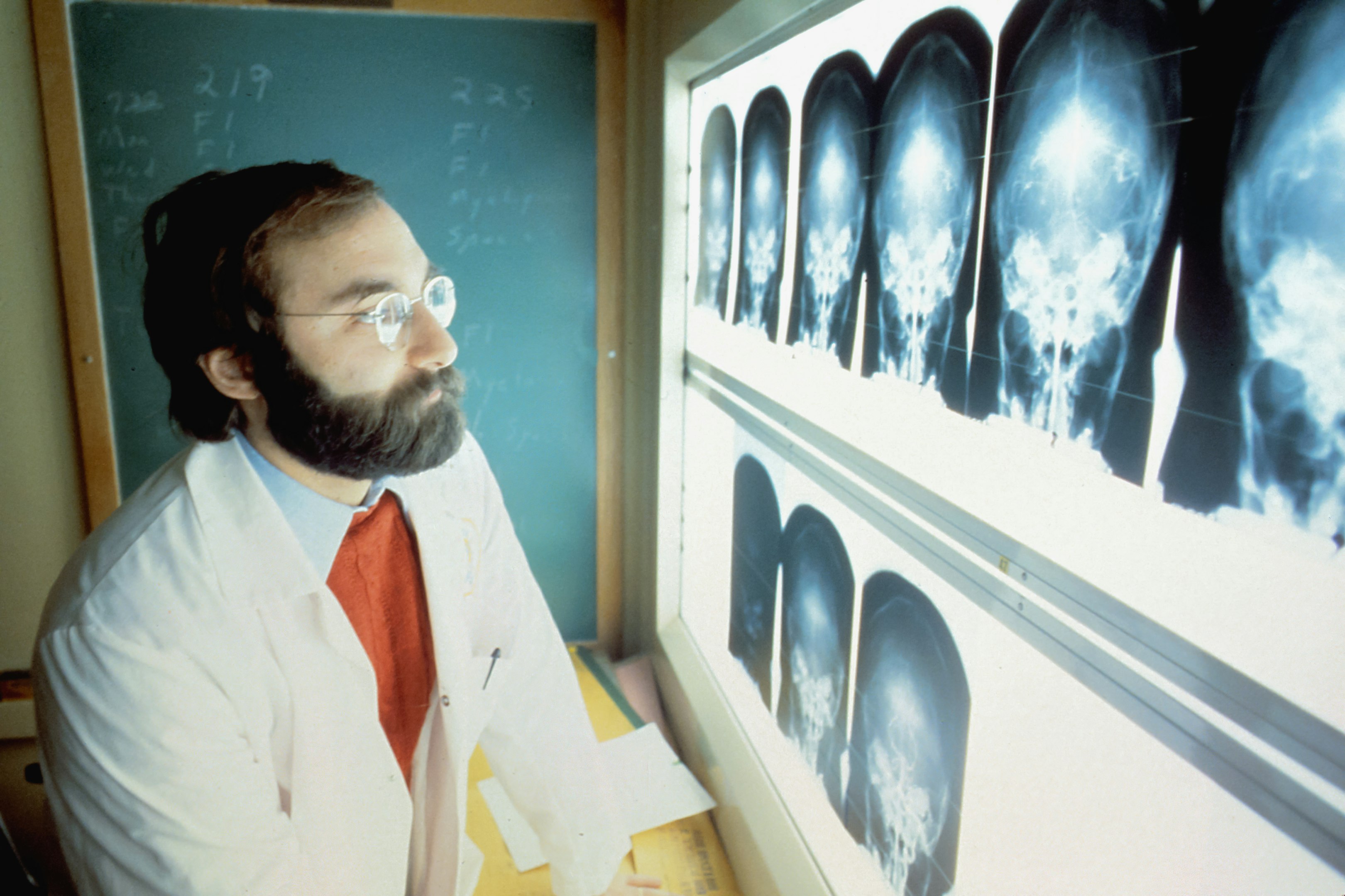 un hombre con bata de laboratorio y corbata mirando una radiografía