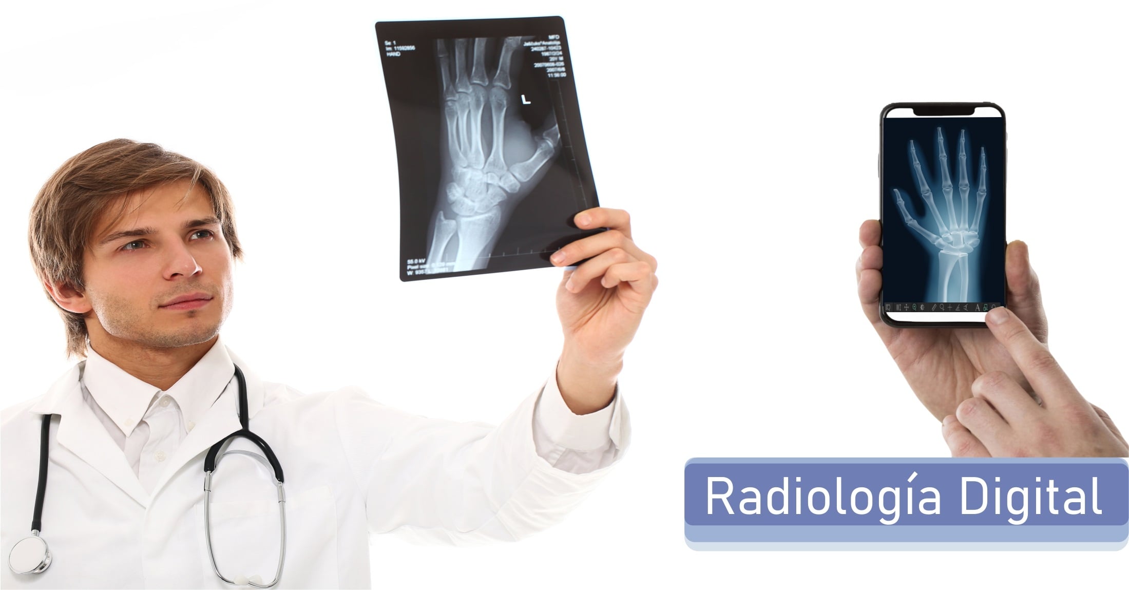 Médico observando una radiografía de mano en formato digital y en papel, concepto de radiología digital.