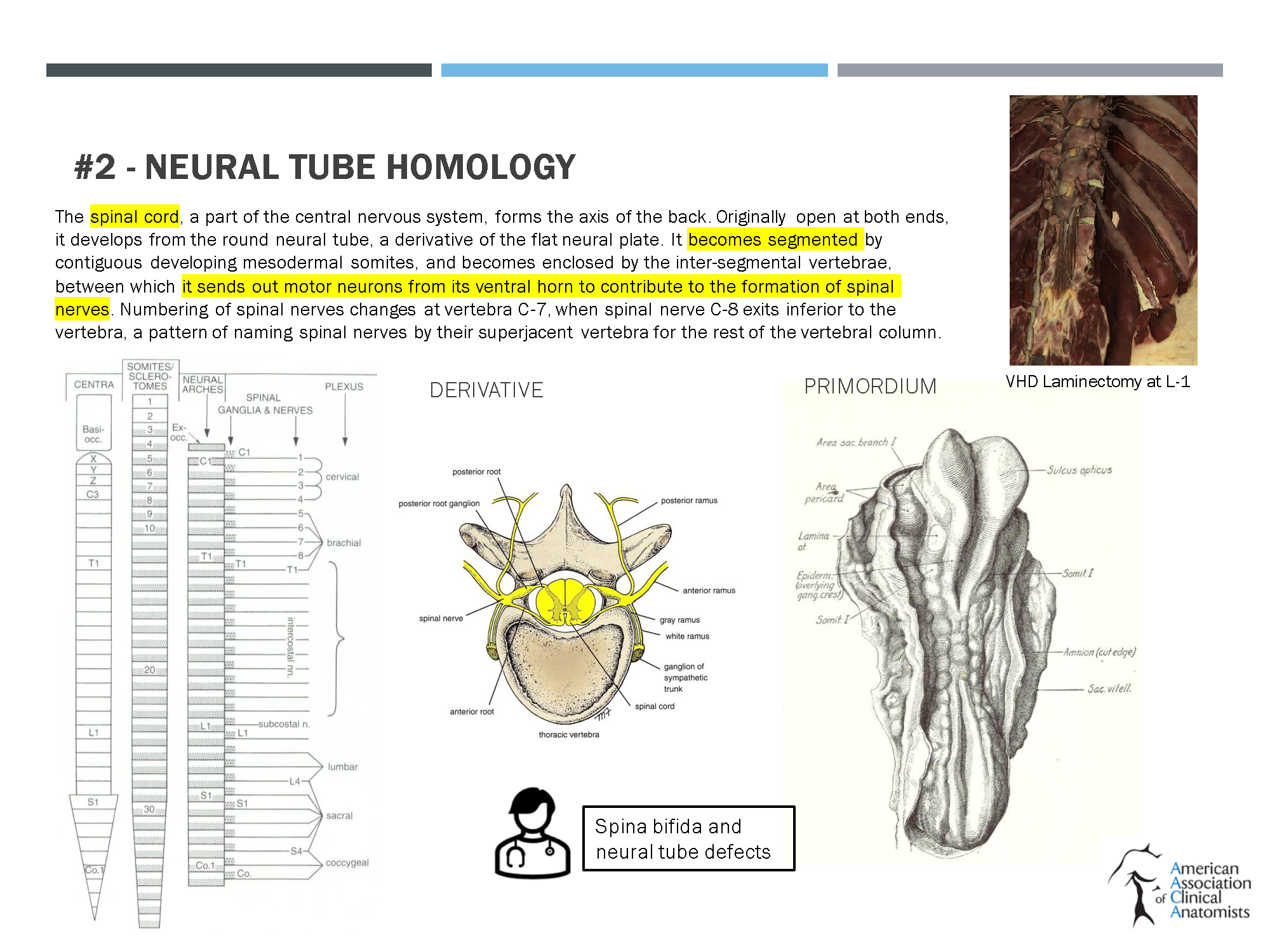 https://0201.nccdn.net/1_2/000/000/130/d0c/boaz-aaca-template-2021-onto-phylogenetic-dissection-of-the-back.png