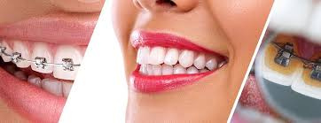 PERIODONCIA