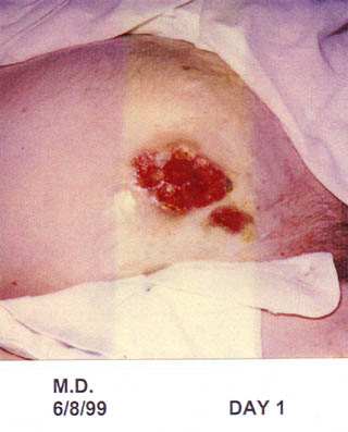 https://0201.nccdn.net/1_2/000/000/13f/689/case10_1.jpg