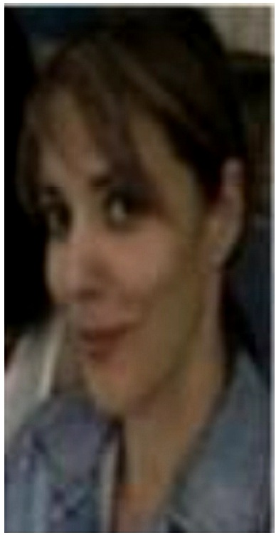 Mi nombre es Sofia, tengo 40 años, desde hace 5 años empecé con síntomas de sangrado intermenstrual que me llevaron a iniciar un largo y desgastante camino entre análisis, tratamientos, terapias donde se podía observar un engrosamiento en el endometrio, que llamaba la atención de los médicos, y atribuible a cambios hormonales.
Cabe mencionar que ninguna de las terapias que intenté, entre ellas cambio de dieta entre otras tuvo resultados en mis síntomas.
Un día acudí́ al laboratorio sol roma a practicarme unos análisis, y fué Estela Arteaga (Quimica Bacteriologa y Parasitologa) quien me habló de una nueva terapia, Simpatología, yo desconocía en qué consistía; tras una explicación informativa, confiando en el conocimiento y profesionalismo de la cual tengo total certeza en la Q.B.P decidí́ aplicarme la primera terapia.
La facilidad de aplicación es de manera ambulatoria, consiste en pequeñas inyecciones en puntos específicos del cuerpo según el síntoma u órgano a tratar, la incomodidad es mínima y pasa después de la aplicación.
En 4ta aplicación, mis síntomas ya habían disminuido además puedo agregar que me sentía mucho más calmada y relajada estaba teniendo mejoría en mi sistema nervioso.
Posteriormente decidí también que me aplicaran para mastopatia fibroquistica pues me causa dolores e incomodidad en la primera aplicación el volumen disminuyo casi instantáneamente, y para la segunda se redujeron aún más.
Actualmente puedo compartirles que el engrosamiento de endometrio por fin se redujo de manera significativa así como los nódulos.
Por último y como uno de los mayores beneficios de esta terapia es que no tiene efectos secundarios, yo les puedo decir que solo he tenido buenos resultados y la recomiendo porque lo he experimentado en mi cuerpo.