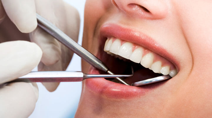 Micro Dental de San Miguel - ENDODONCIA