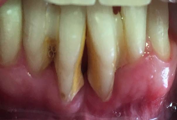 Periodoncia