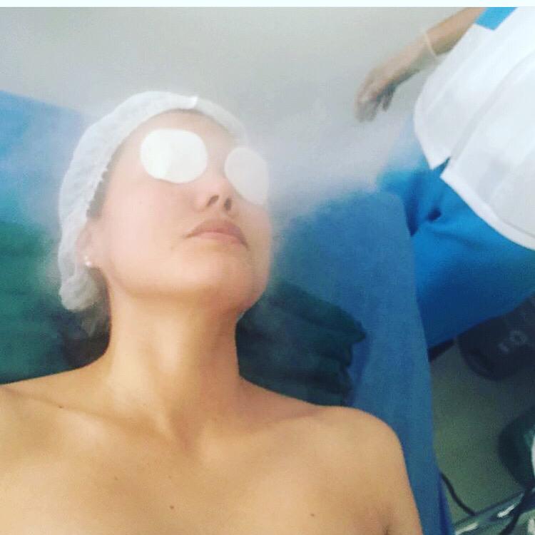 Tratamientos para tu piel