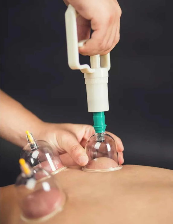 BG-24
VENTOSAS DE PLASTICO
DE SUCCION E IMAN