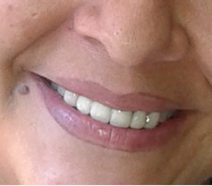 Sonrisa AJV