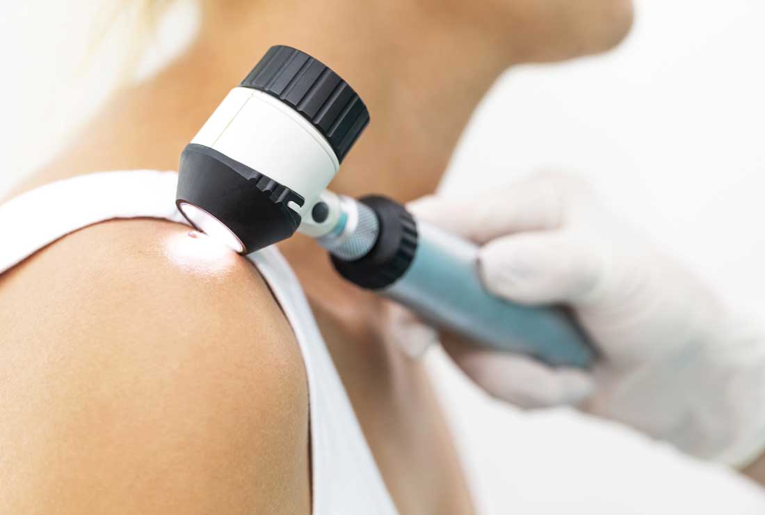 SPDERMATOLOGIA - consultas en piel