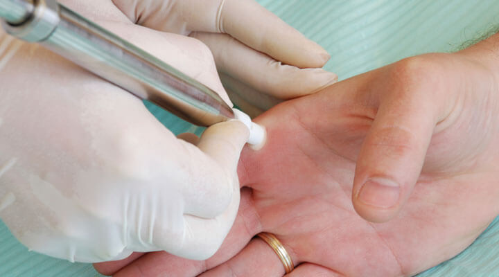 Dermatología Integral "Medica Grijalva"  - TOMA DE BIOPSIAS