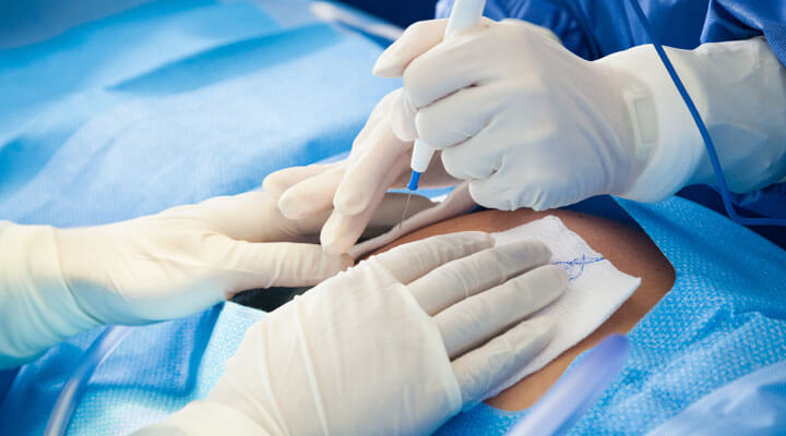 Clínica Corvalen - BARIATRICA