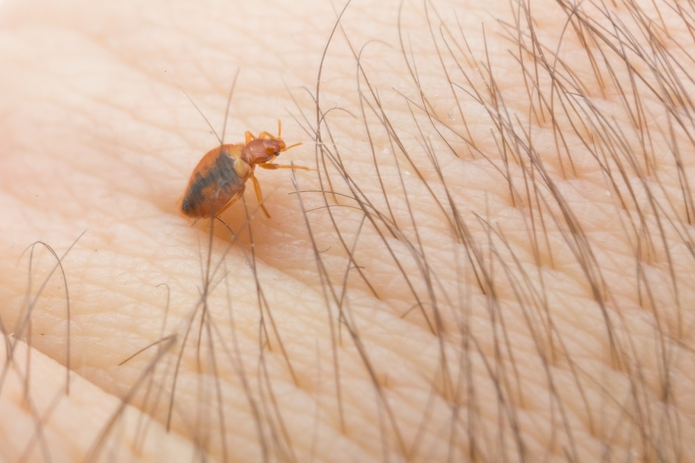 Bed bug on skin
