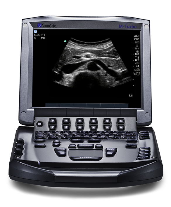 https://0201.nccdn.net/1_2/000/000/170/120/ecografo-sonosite-585x710.png