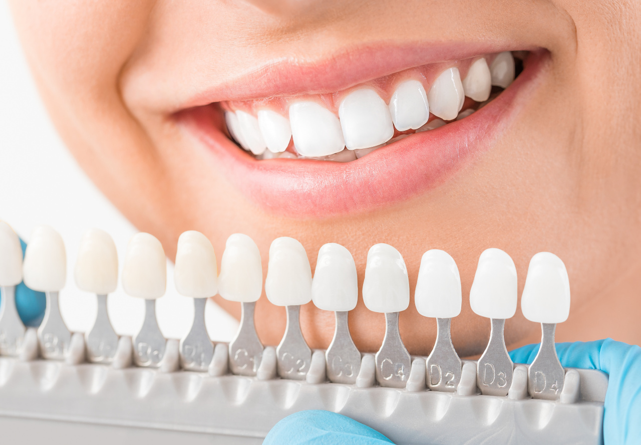 Row of implants held near smiling mouth Row of implants held near smiling mouth