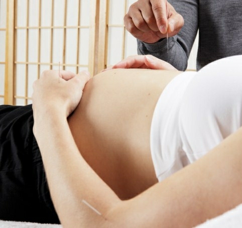 Acupuncture therapy, treatment||||