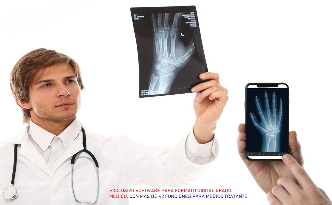 Médico observando una radiografía de mano en formato digital y en papel, concepto de radiología digital. Médico observando una radiografía de mano en formato digital y en papel, concepto de radiología digital.