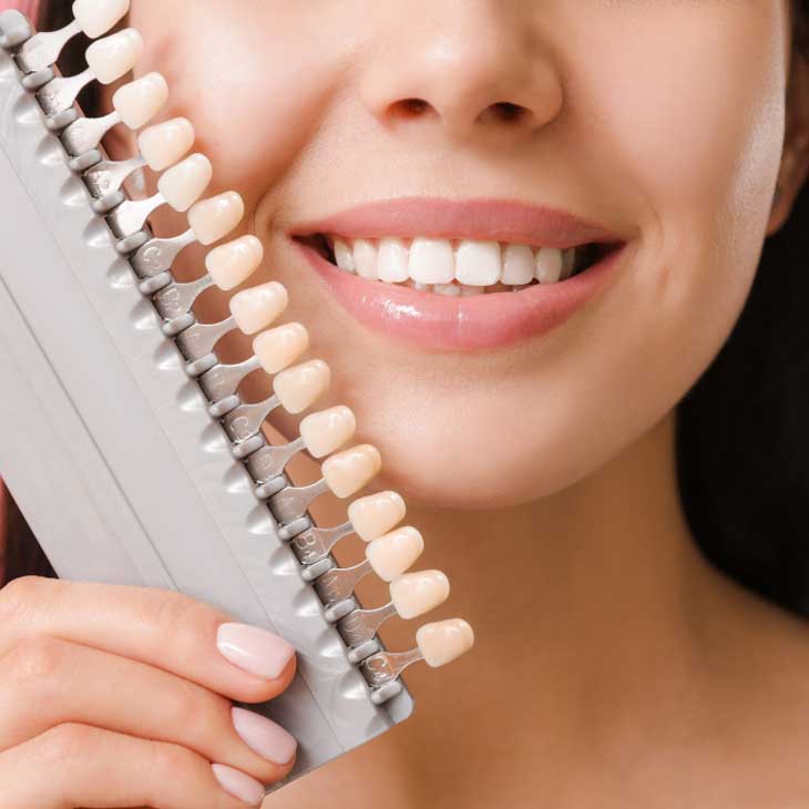 Odontosur Odontología de Alta Especialidad - blanqueamiento dental