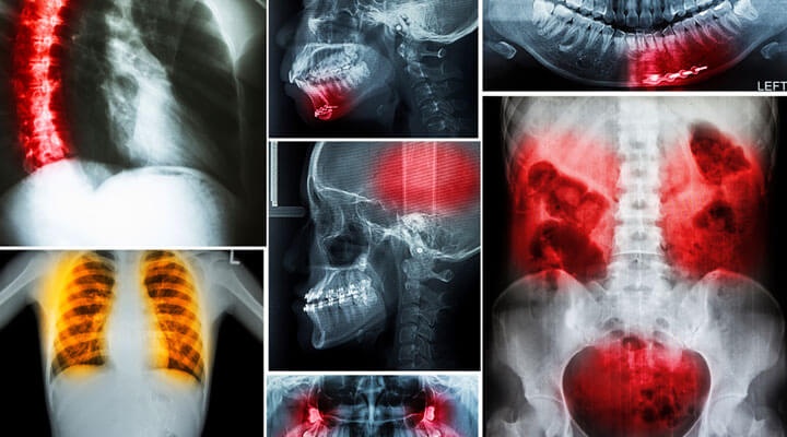 Imagenología De La Cruz SC - RADIOLOGIA INTERVENCIONISTA