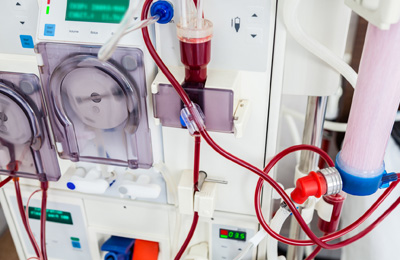 Dialysis Device with Rotating Pumps