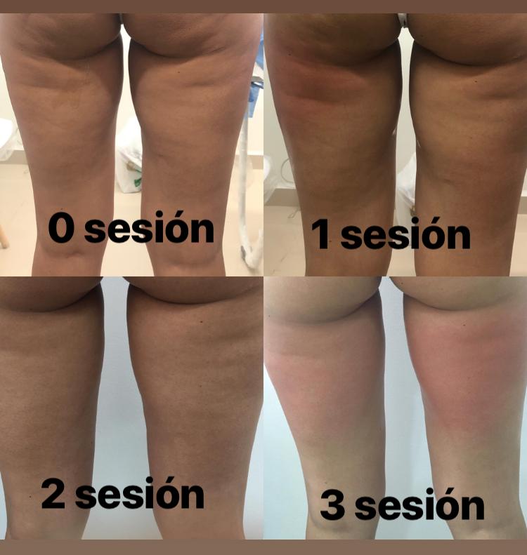 Resultados Venus Legacy